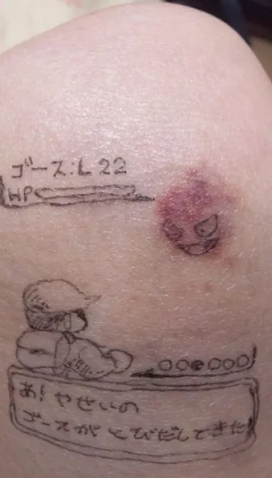 Cuando un gastly salvaje aparece en tu piel